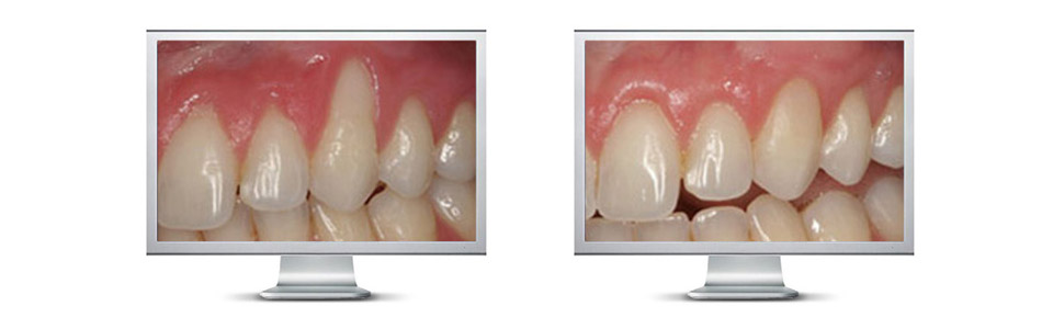 Periodoncia